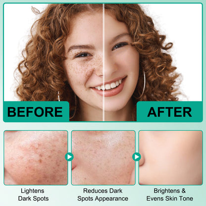 IKZEE Deep Repair Dark Spot Correcting Serum 50ml