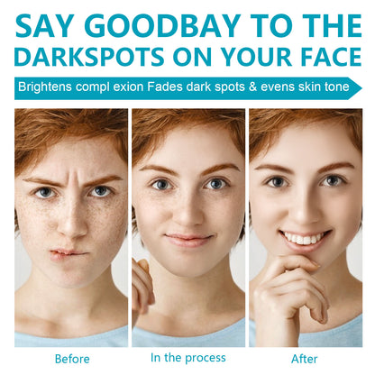 ELAIMEI Triple Action Dark Spot Corrector Cream 50ml